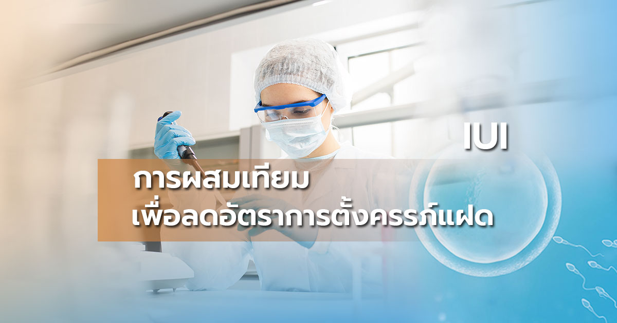 การผสมเทียม