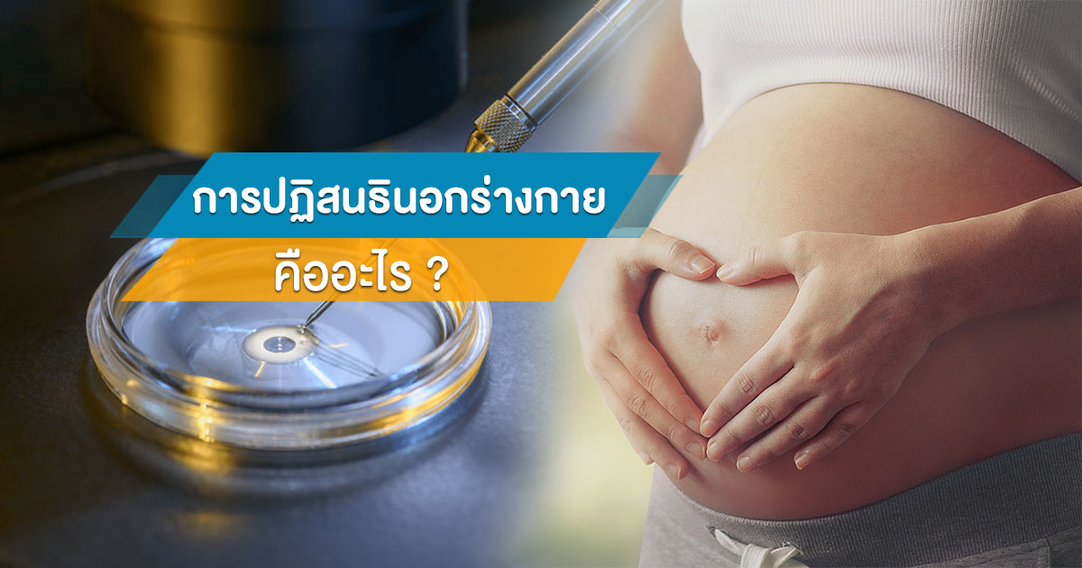 ivf